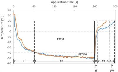 Thawing plateau time indicating the duration of phase transition from ice to water is the strongest predictor for long-term durable pulmonary vein isolation after cryoballoon ablation for atrial fibrillation—Data from the index and repeat procedures